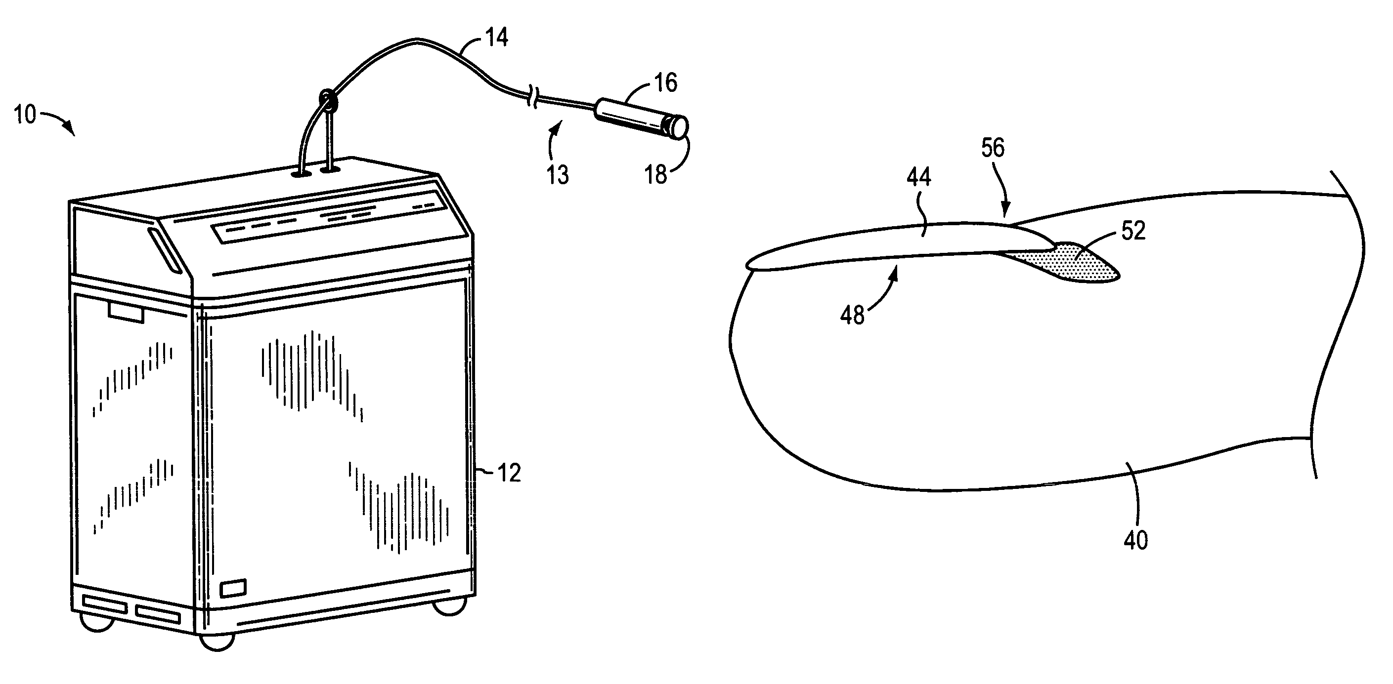 Method and apparatus for treating a diseased nail