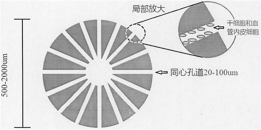 Neural unit spherical support and preparation thereof