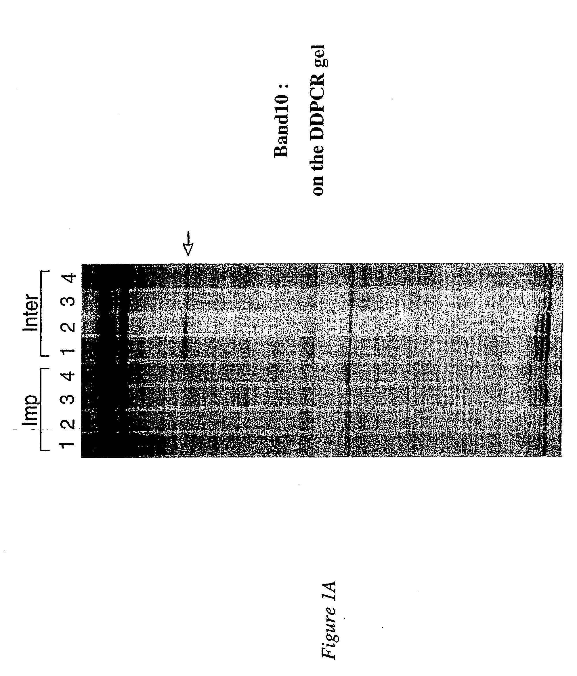 Novel serine protease