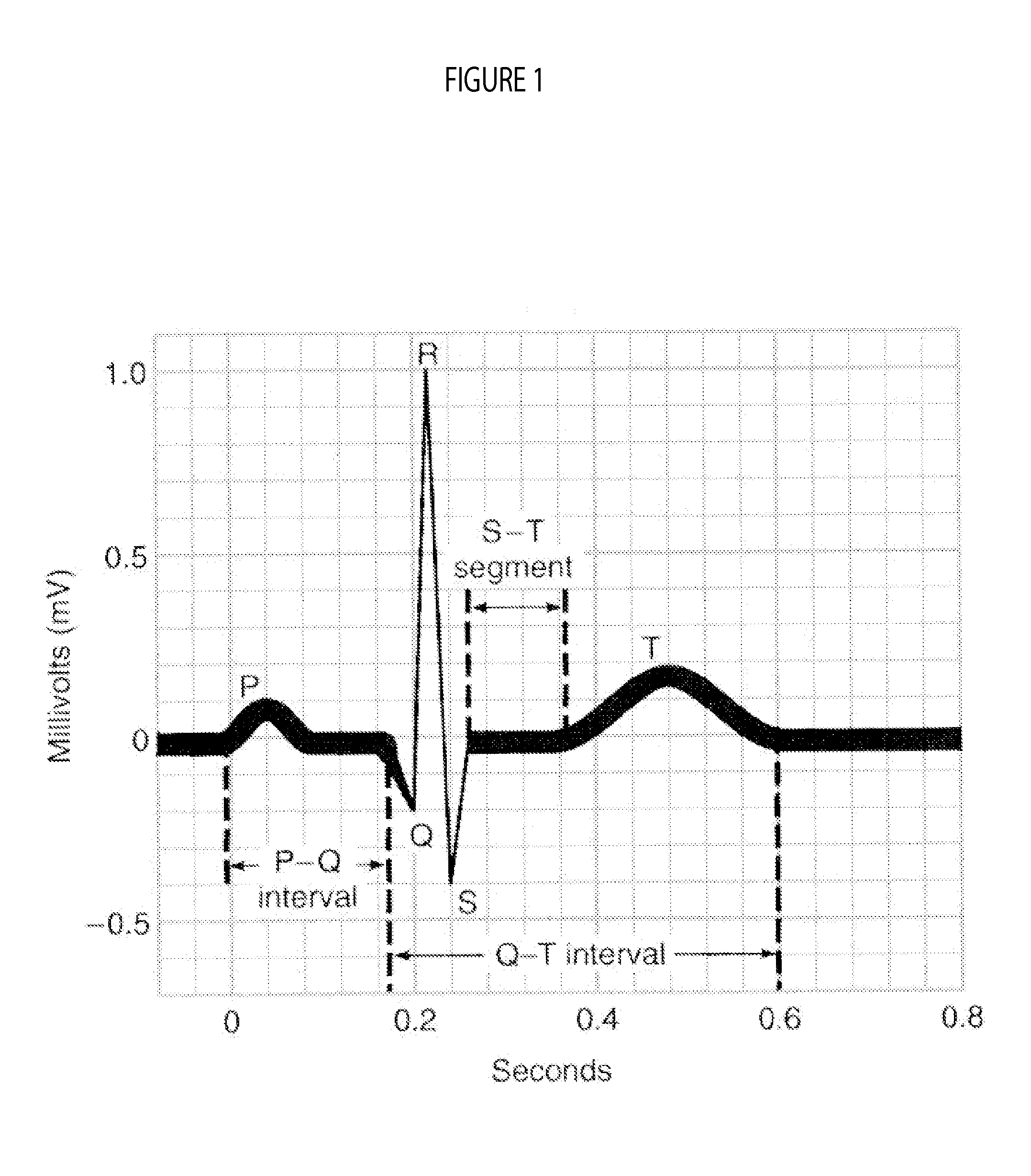 Automated Cardiac Status Determination System