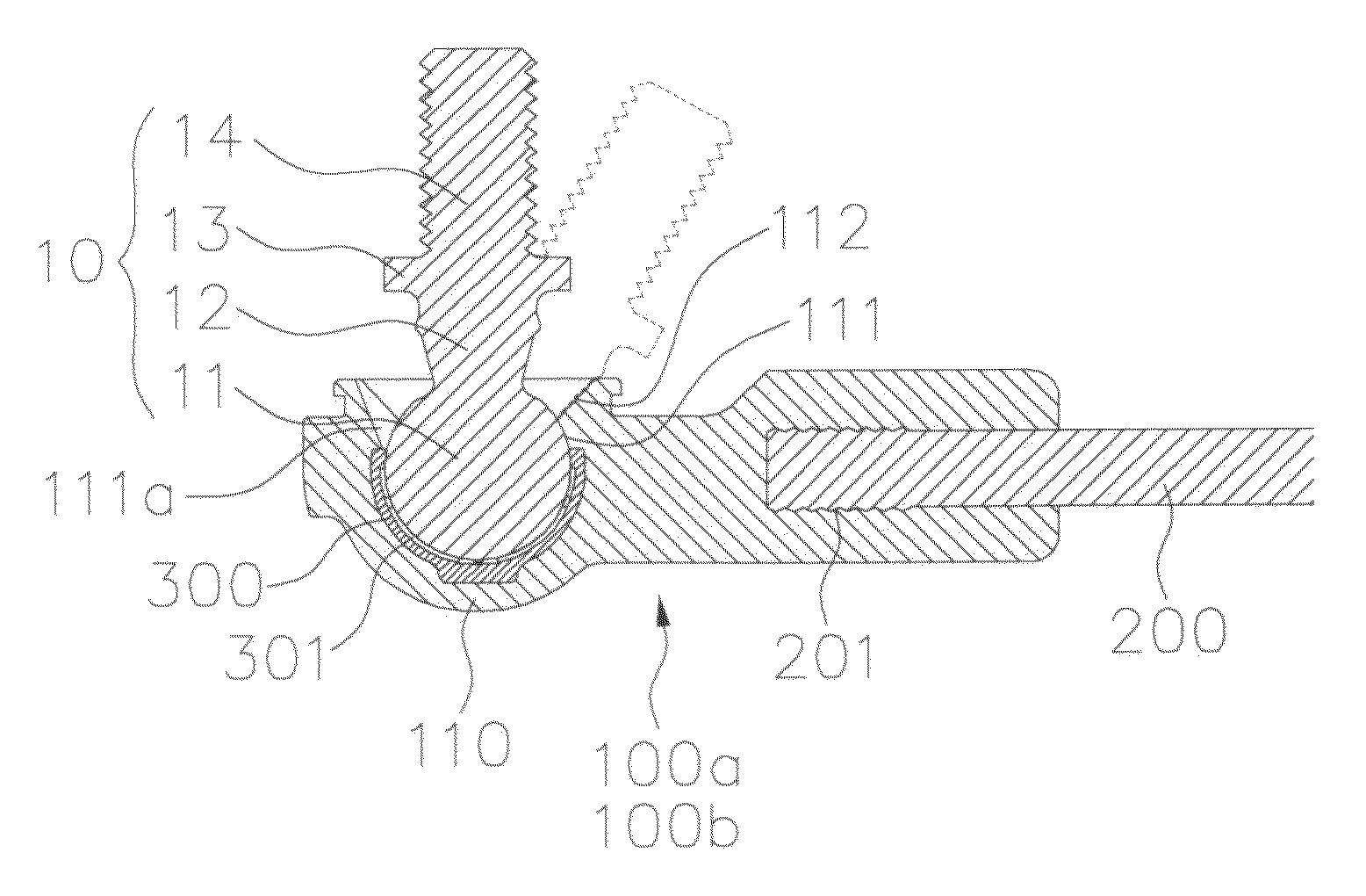 Insert-molded ball joint