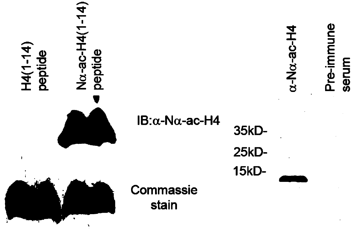 Marker related to auxiliary diagnosis of non-small cell lung cancer and application thereof