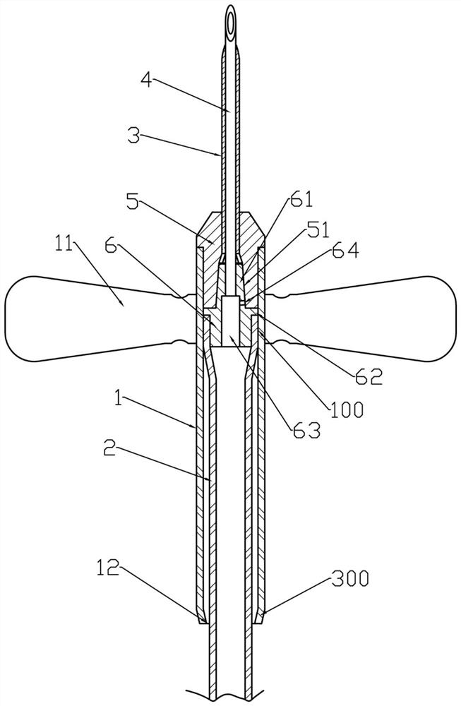 Sleeve type multifunctional puncture-proof indwelling needle