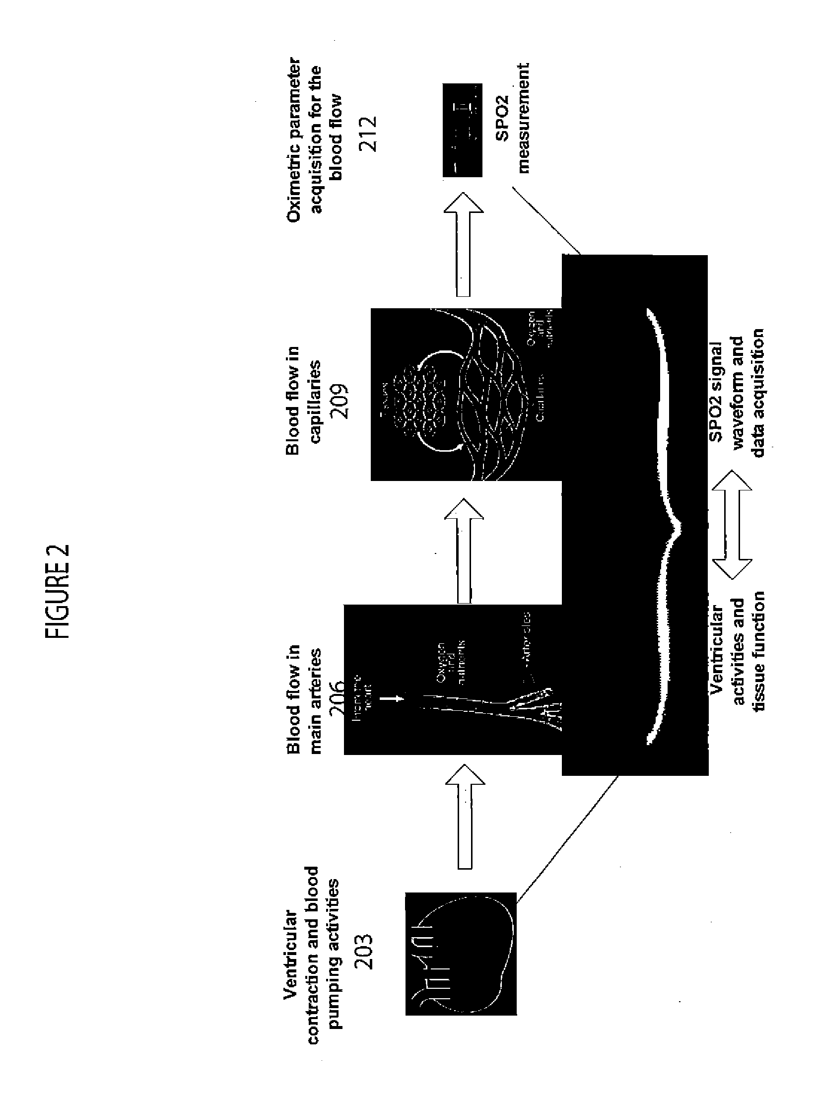 System for Ventricular Arrhythmia Detection and Characterization