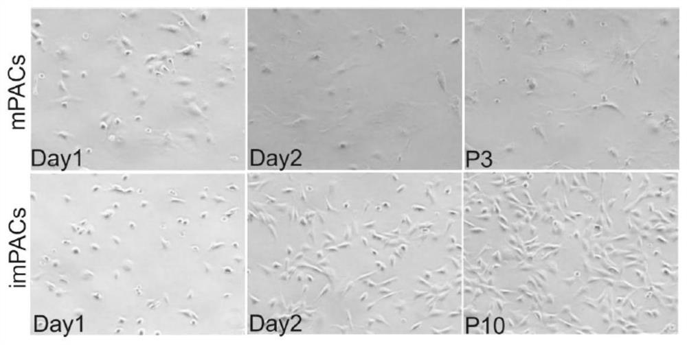 Reversible immortalized II-type alveolar epithelial cell as well as construction and application thereof