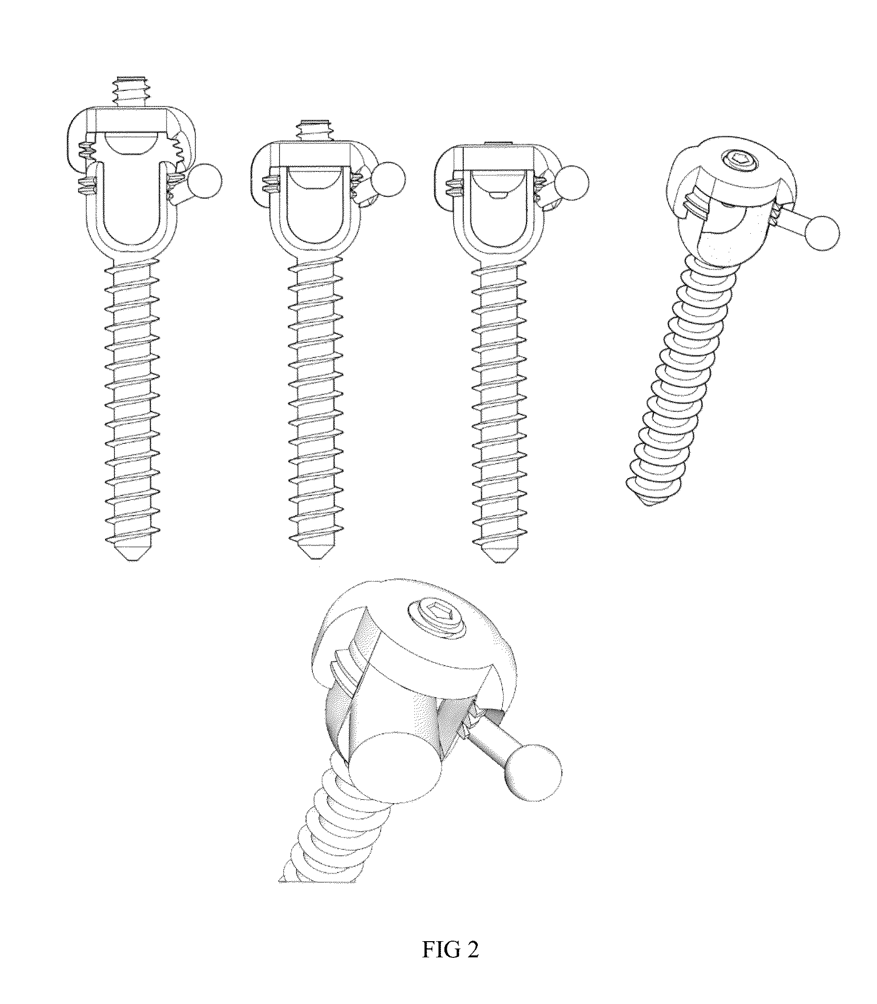 Method and System for the Treatment of Spinal Deformities