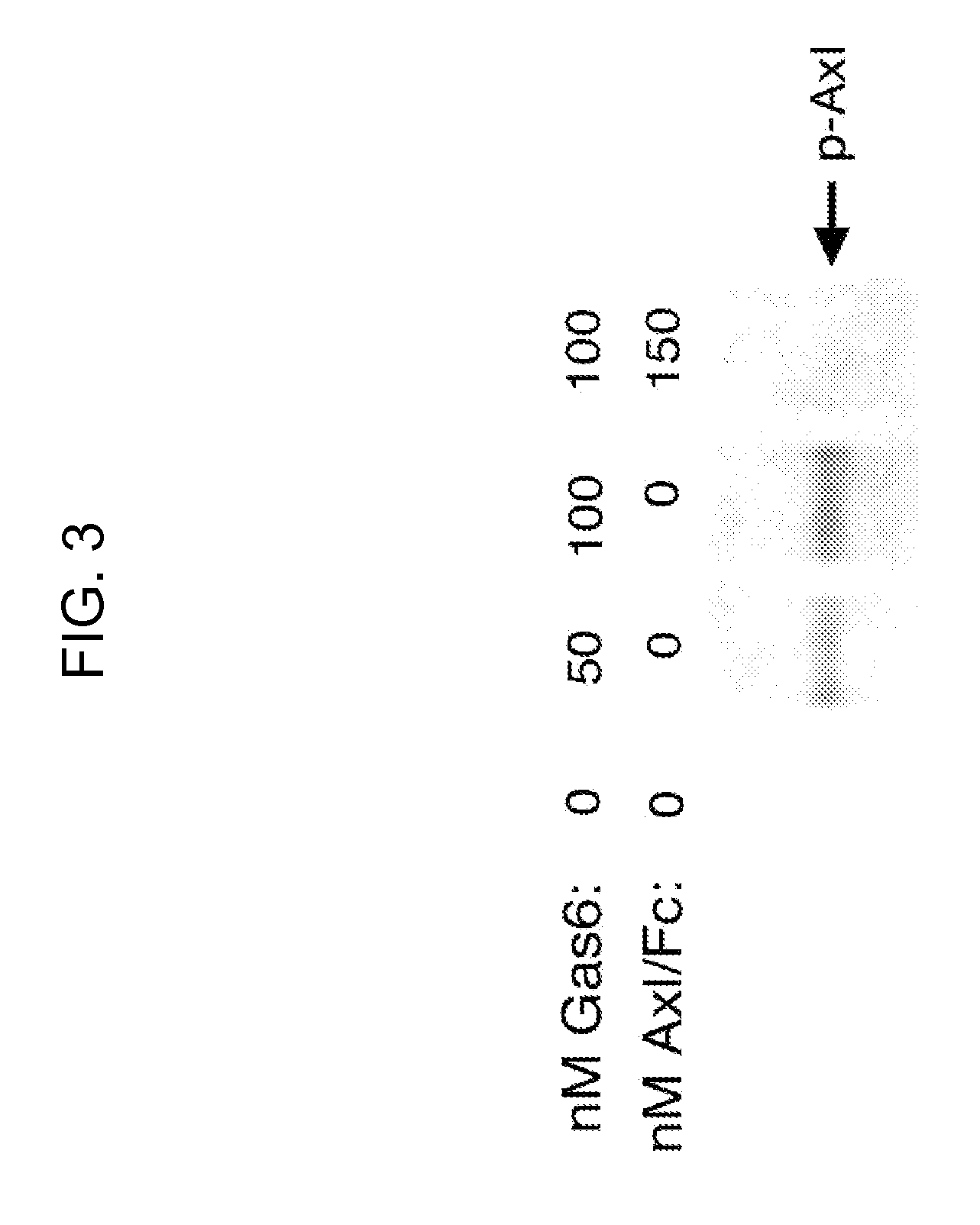 Axl fusion proteins as Axl tyrosine kinase inhibitors