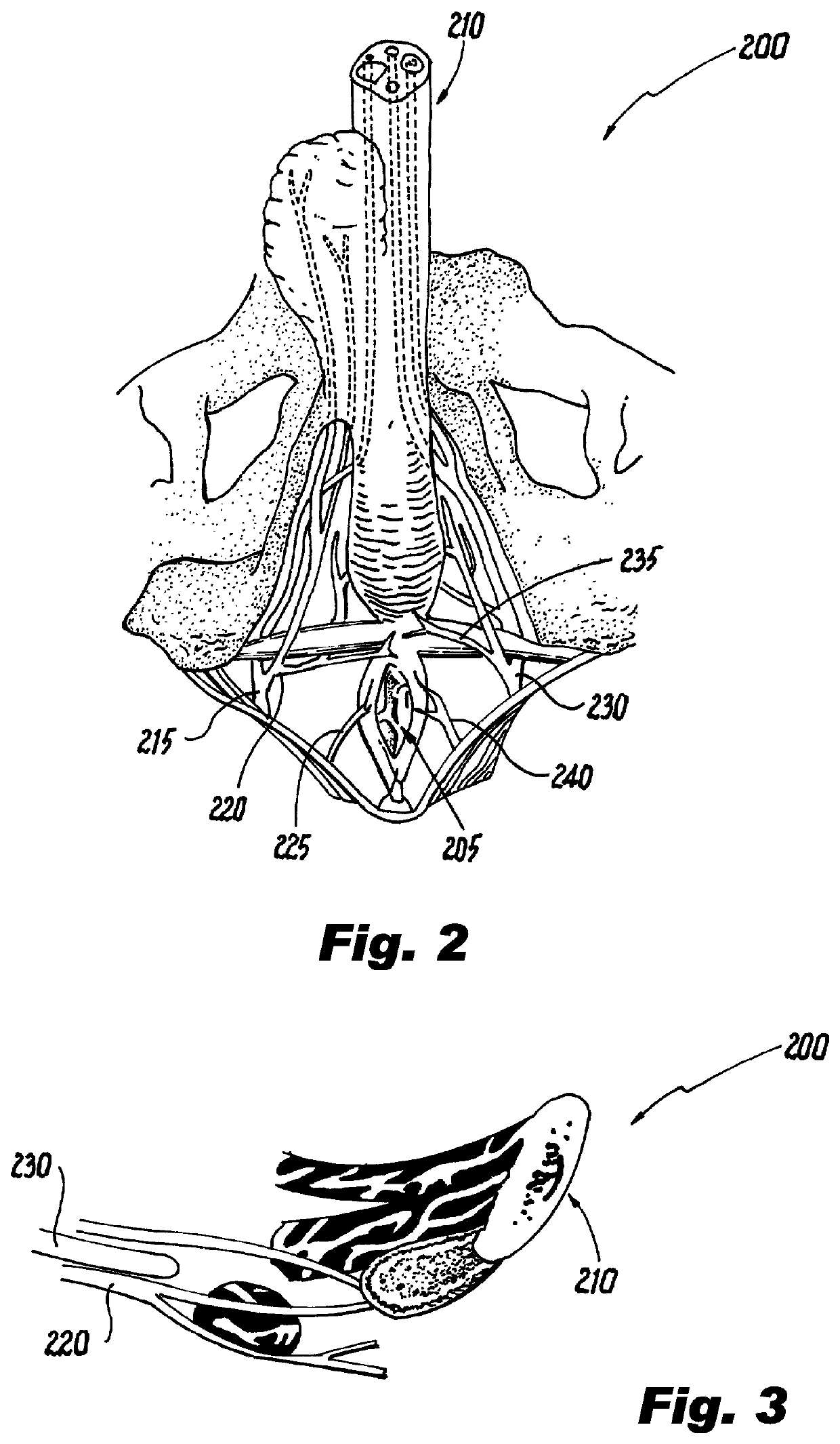 Bicycle saddle