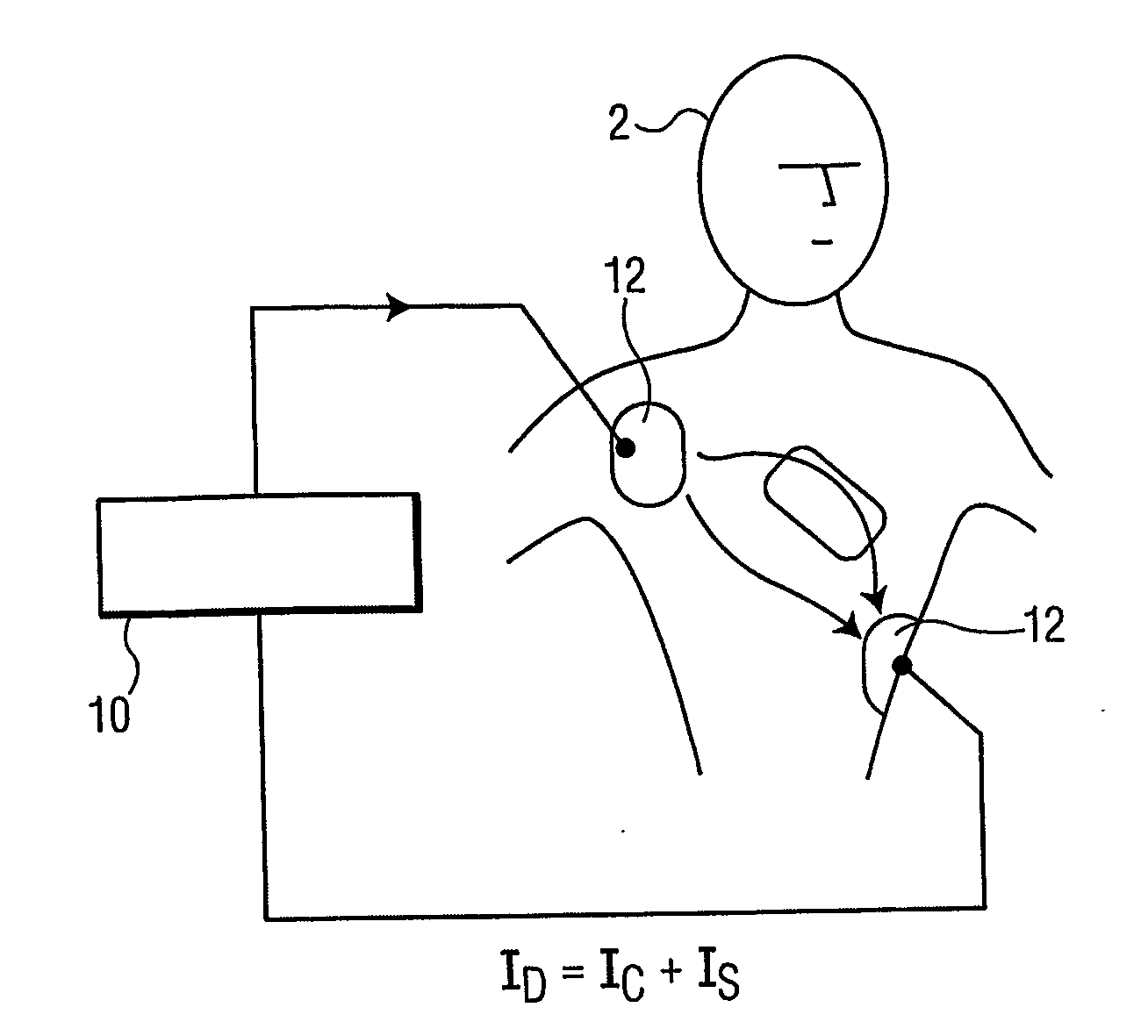 Compensation for cardiac shunt currents during defibrillation