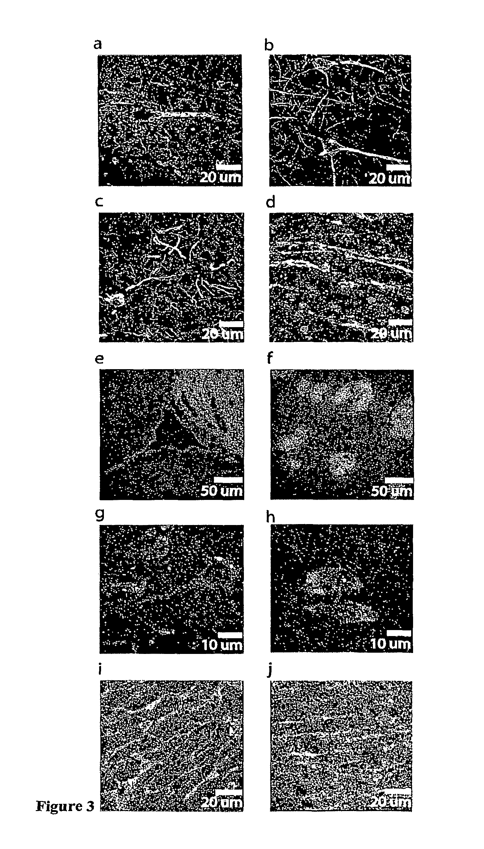 Tissue sample preparation and MALDI MS imaging thereof