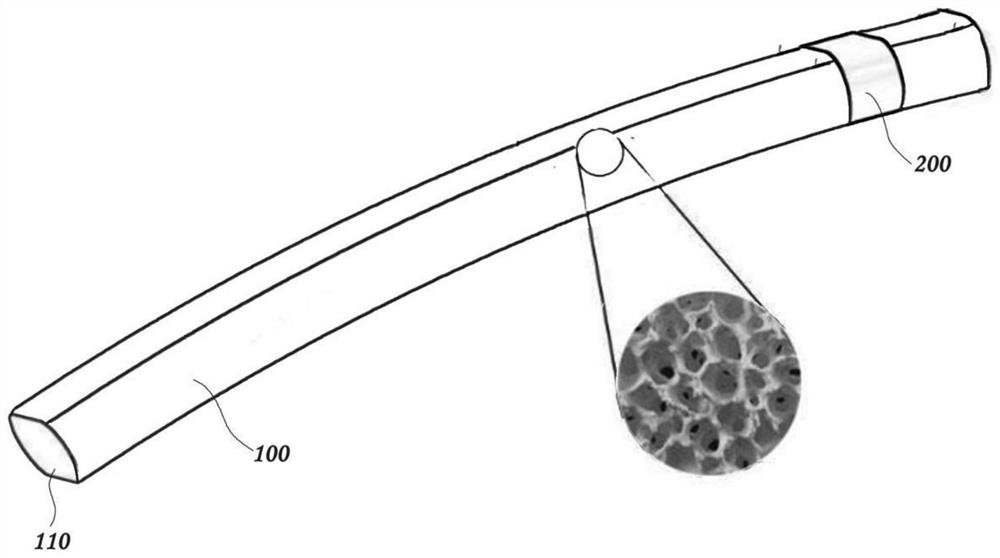 Drainage device suitable for glaucoma treatment