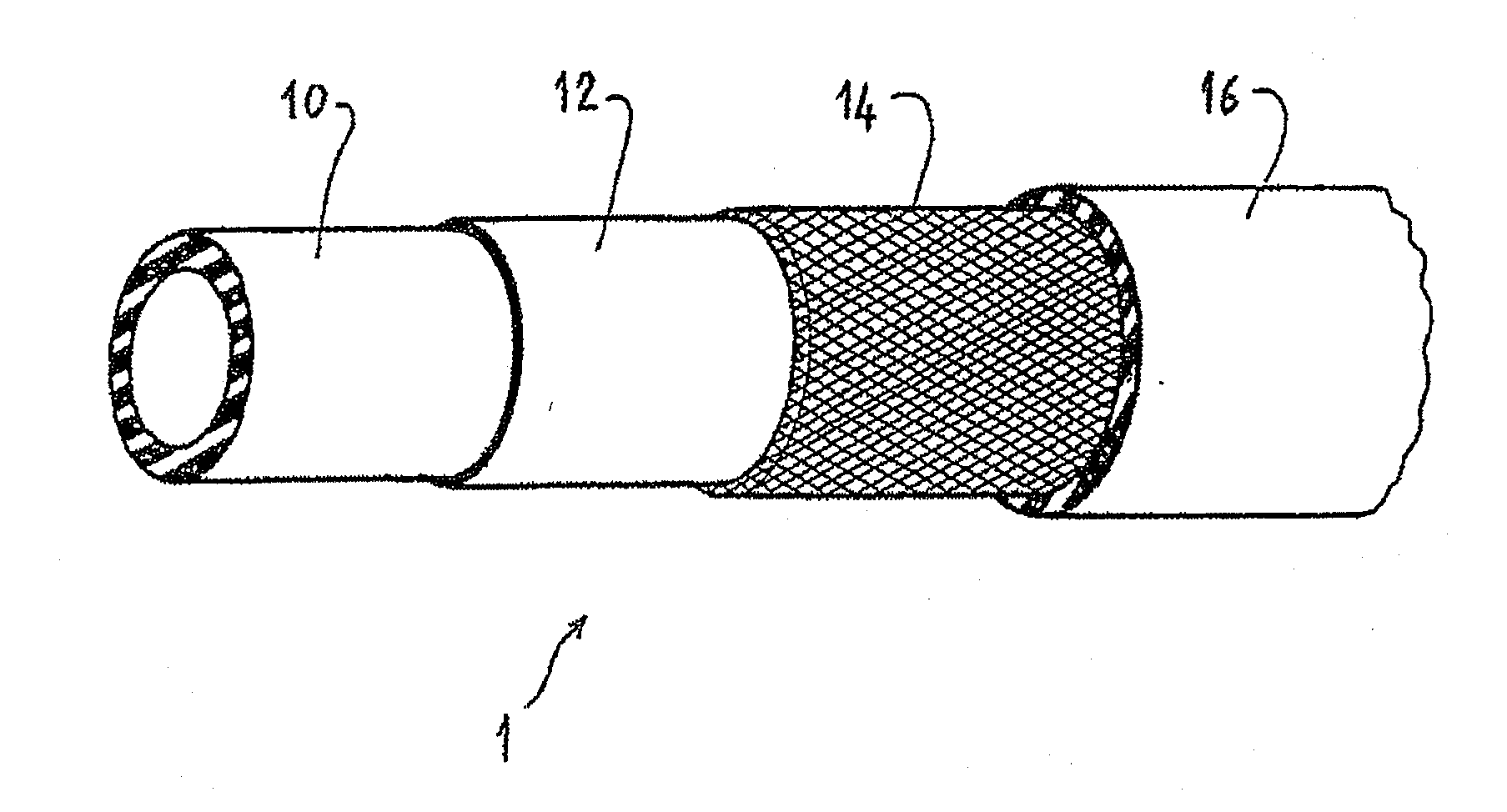 Pipe for the Air Intake Circuit of a Motor Vehicle Engine, and Circuit Incorporating the Same