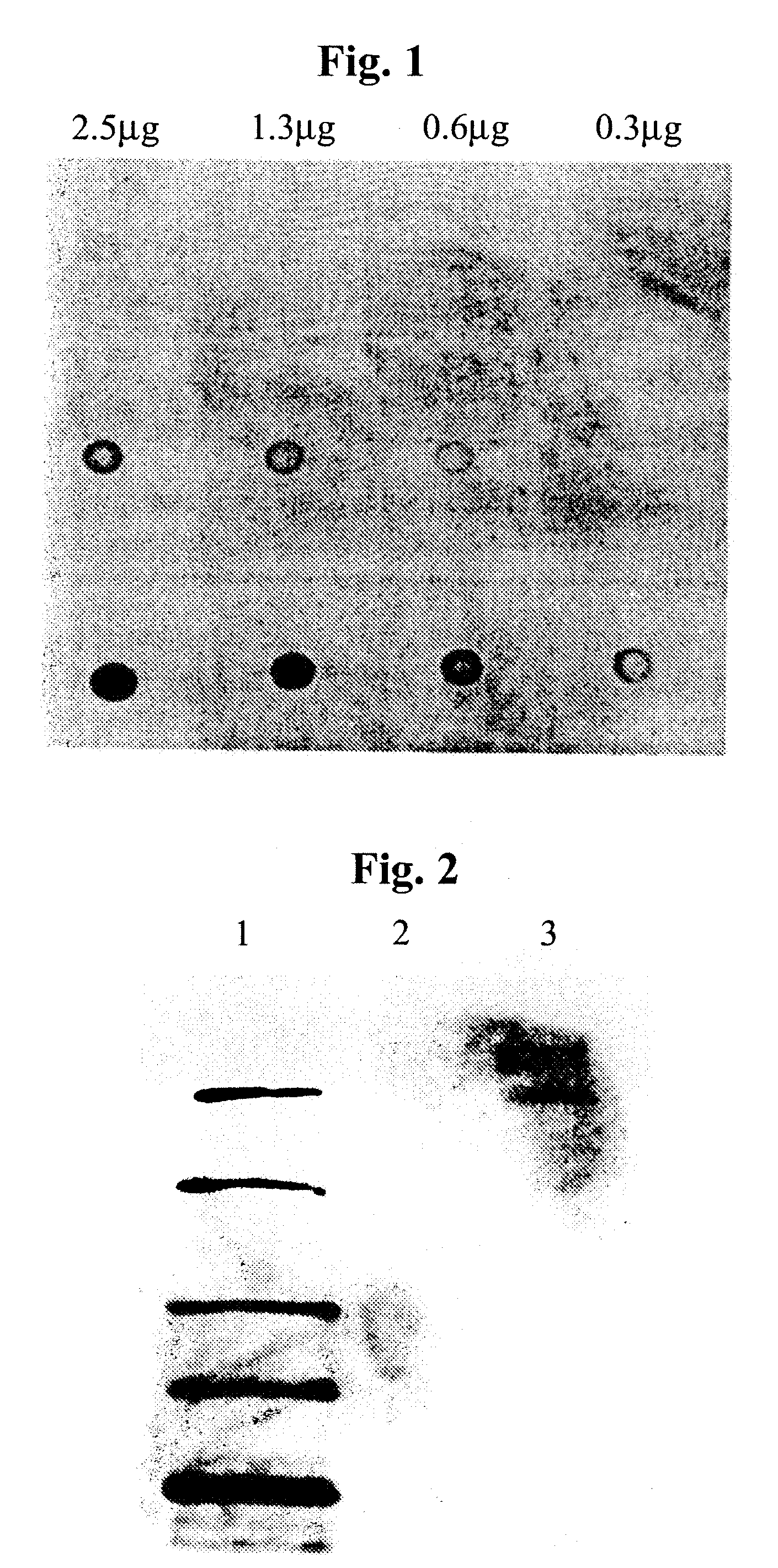 Treatment of mucus hypersecretion