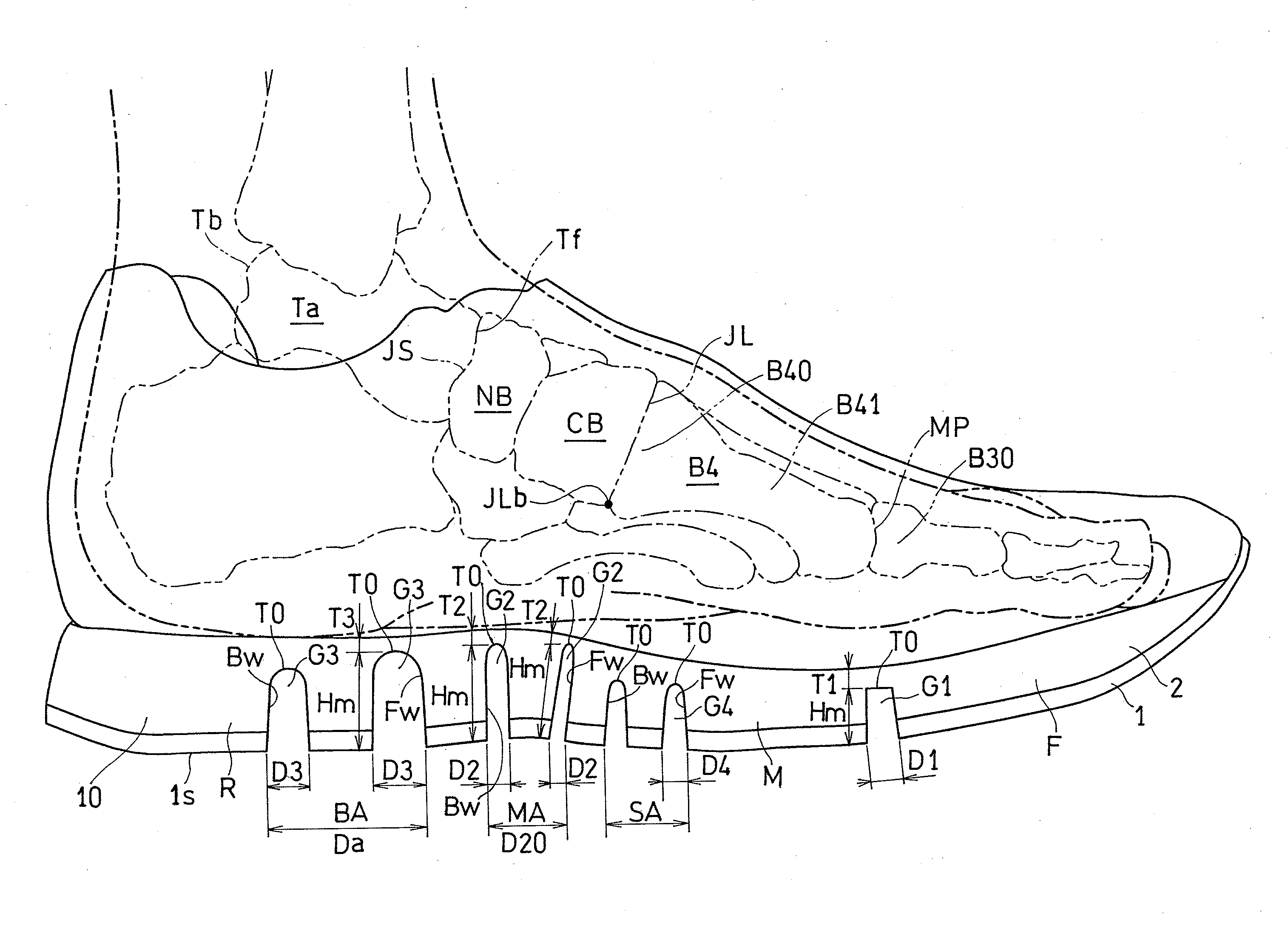 Shoe Sole Focusing on Windlass Mechanism