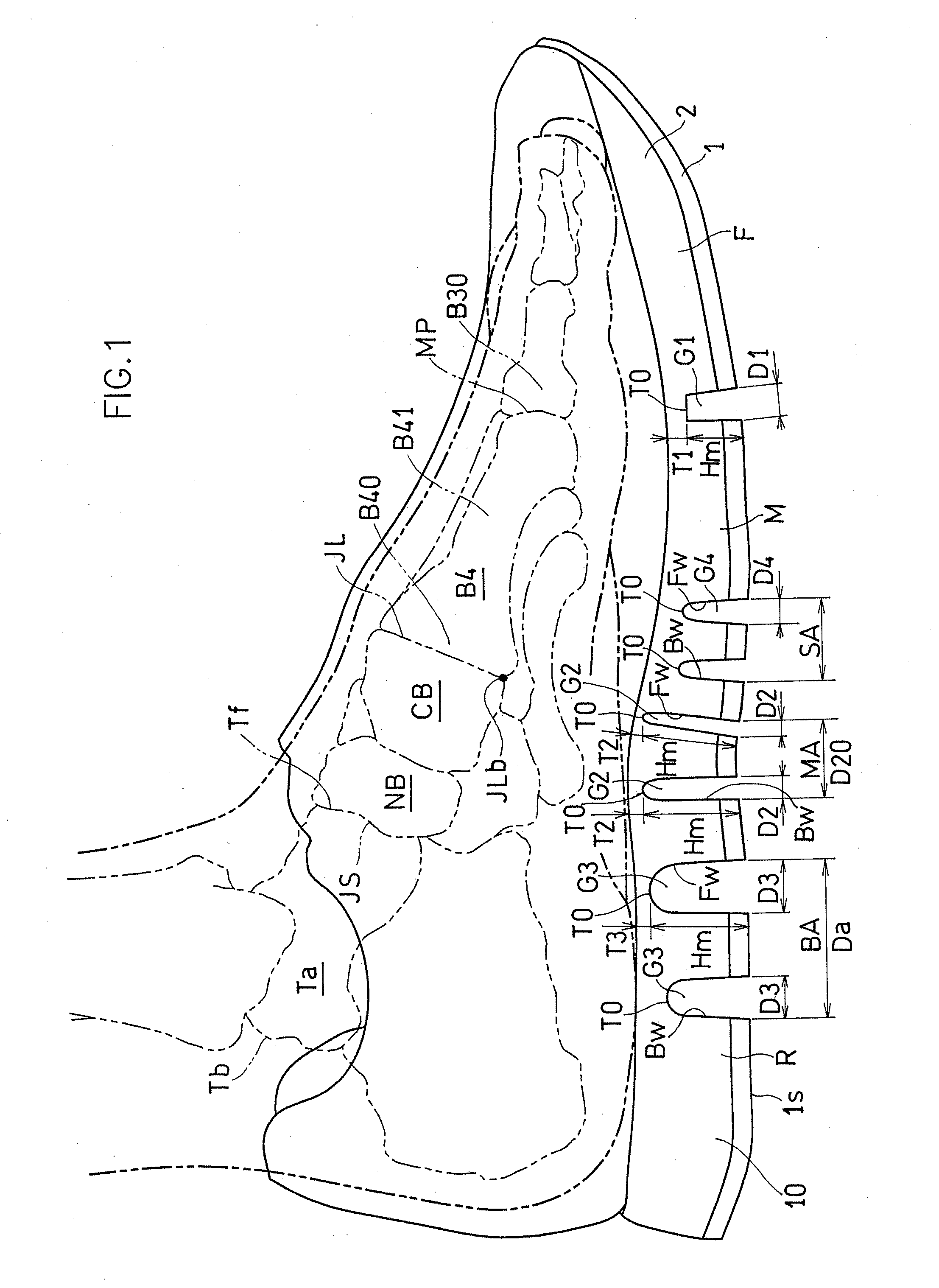 Shoe Sole Focusing on Windlass Mechanism