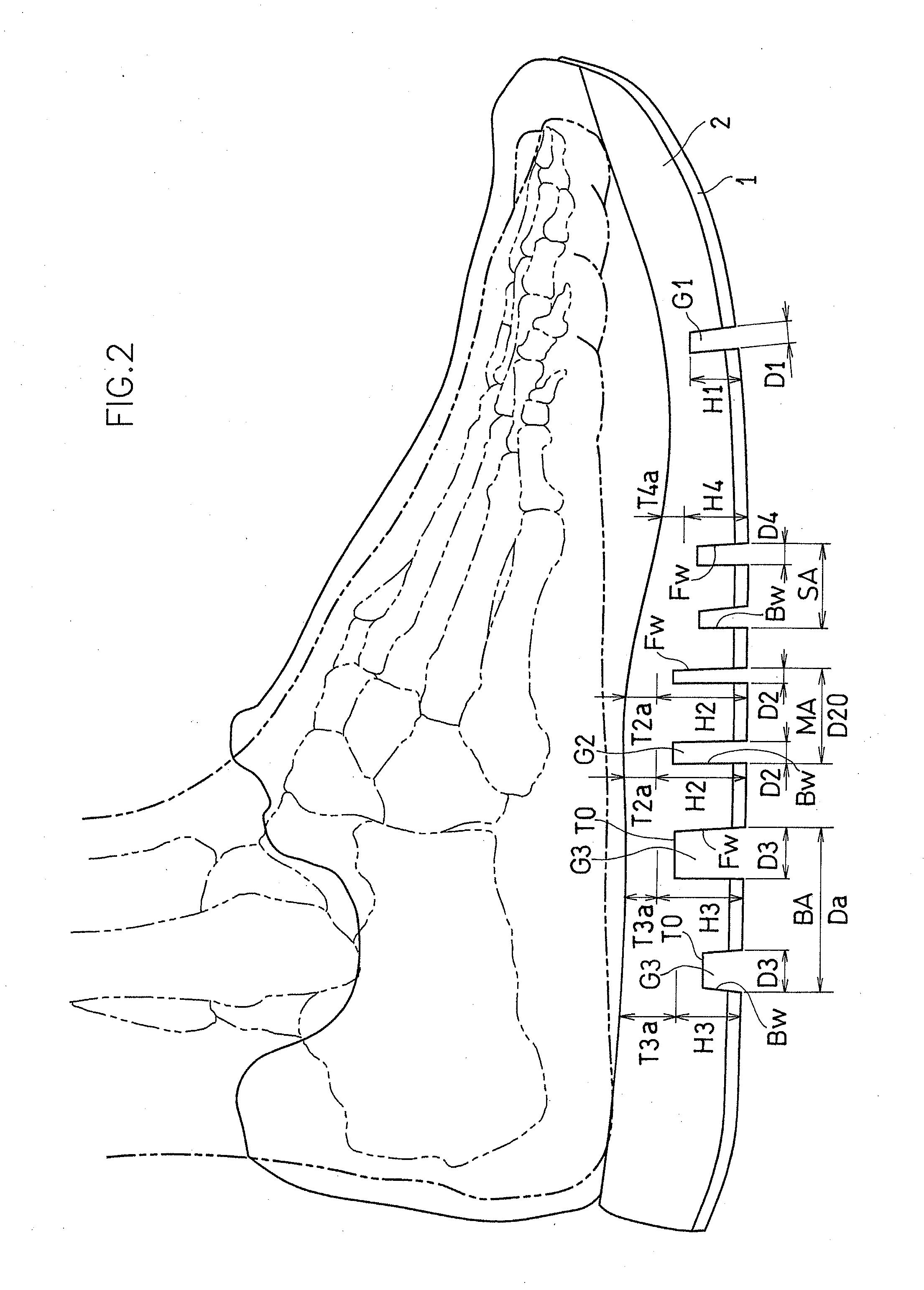 Shoe Sole Focusing on Windlass Mechanism