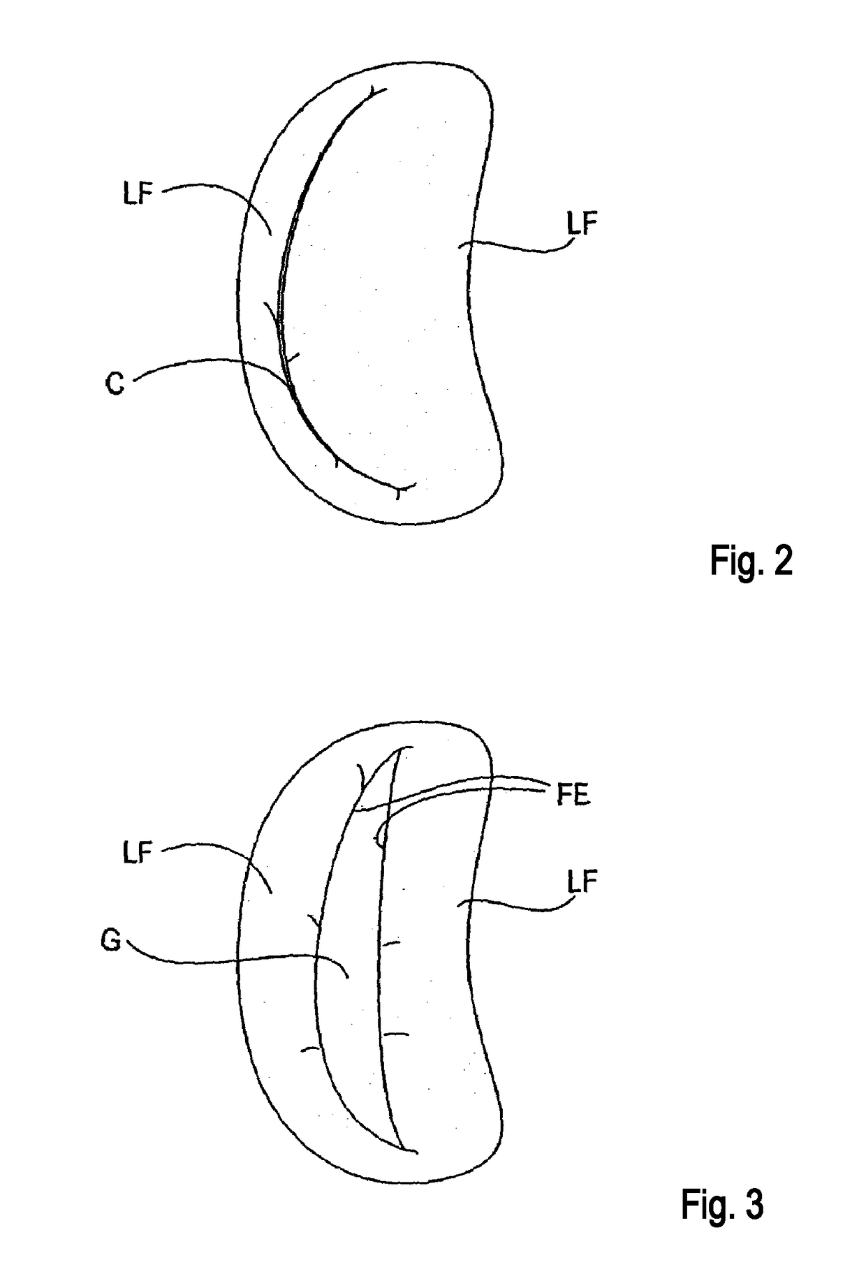 Delivery catheter handle and methods of use