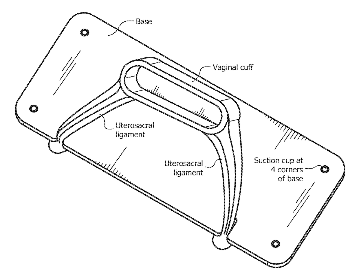 Synthetic vaginal cuff model and method of simulating vaginal cuff closure