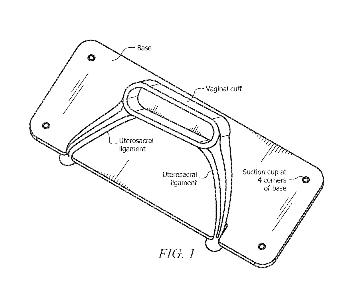 Synthetic vaginal cuff model and method of simulating vaginal cuff closure