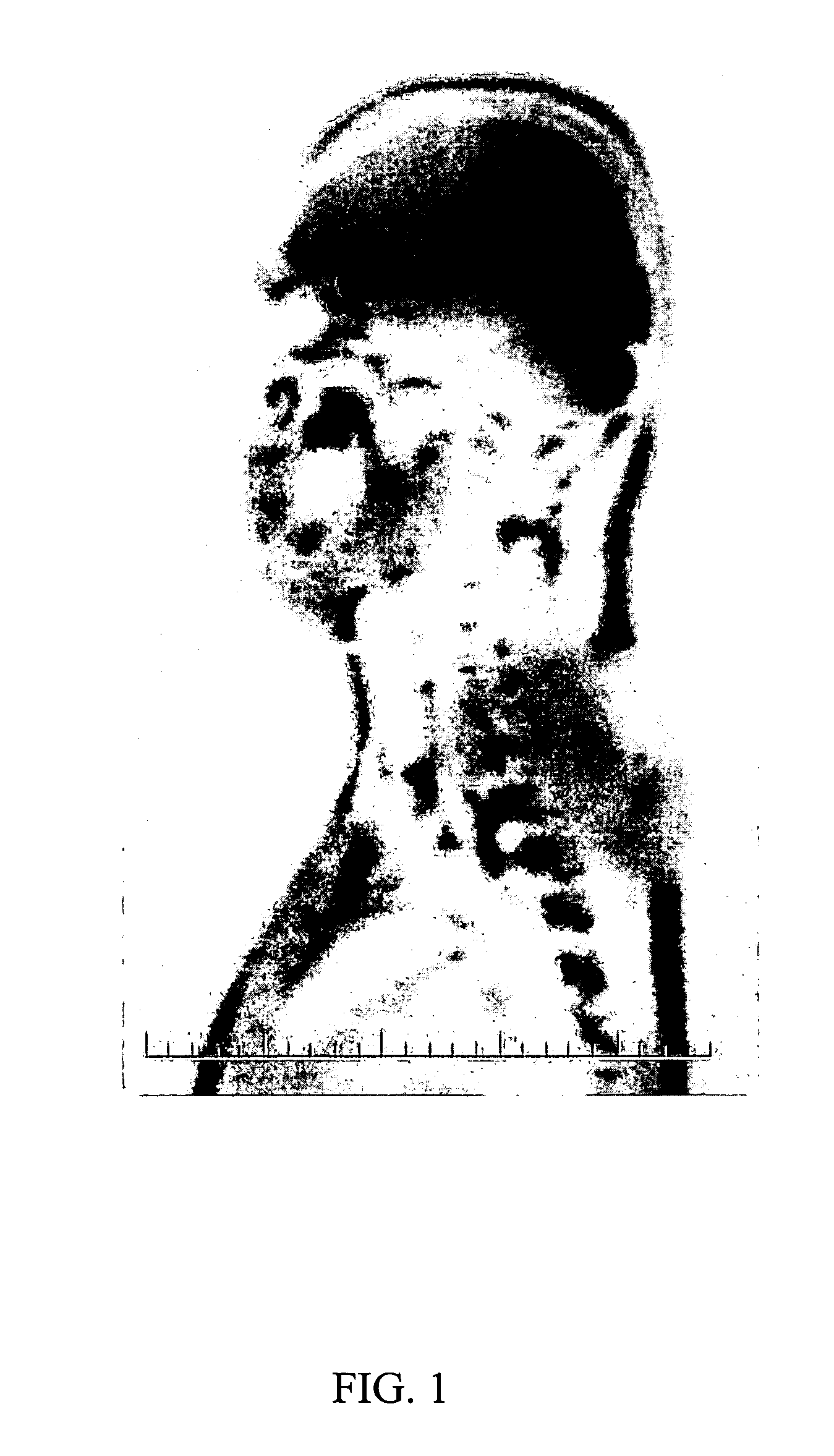 Method and system for optimized pre-saturation in MR with corrected transmitter frequency of pre-pulses