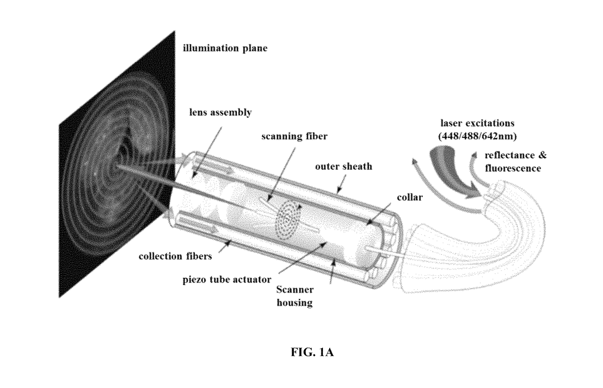 Multispectral wide-field endoscopic imaging of fluorescence