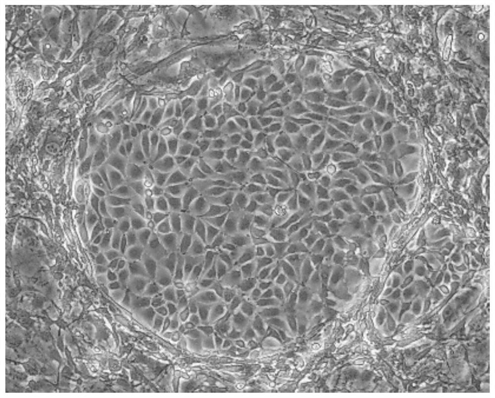 Construction method and culture system of urine-derived renal stem cell three-dimensional differentiation model