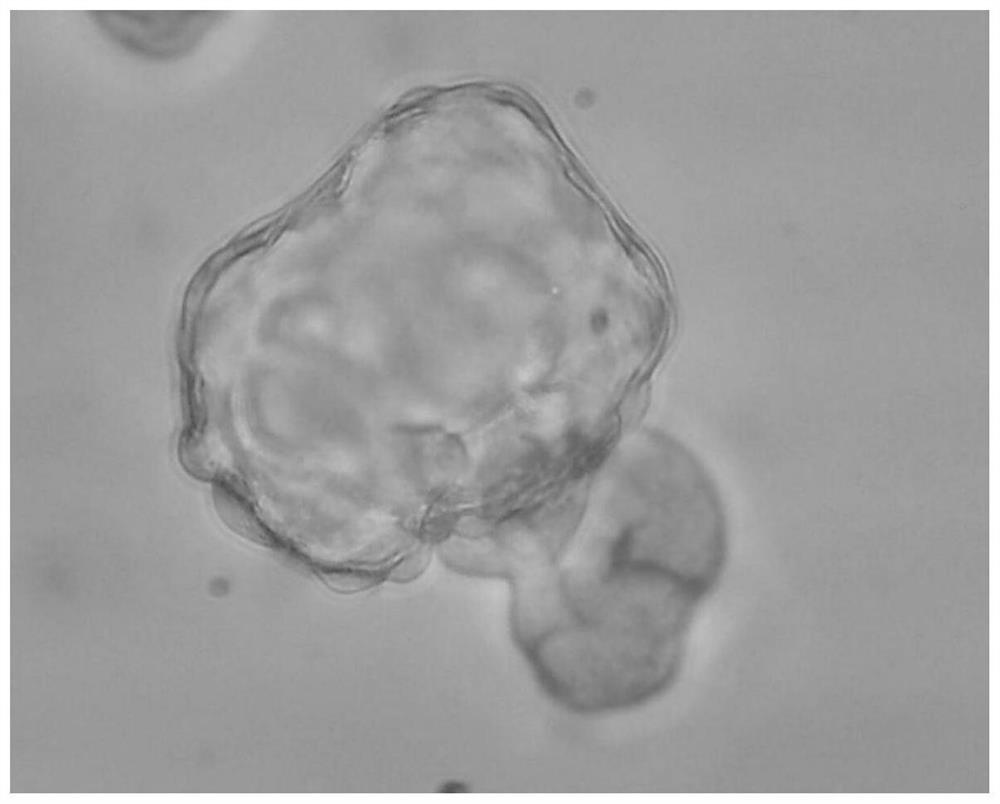 Construction method and culture system of urine-derived renal stem cell three-dimensional differentiation model