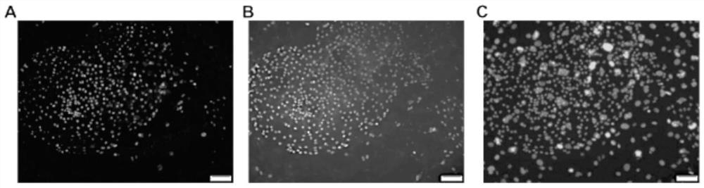 Construction method and culture system of urine-derived renal stem cell three-dimensional differentiation model