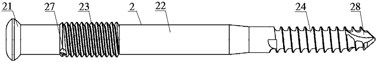 Proximal femoral cross-locking type intramedullary nail