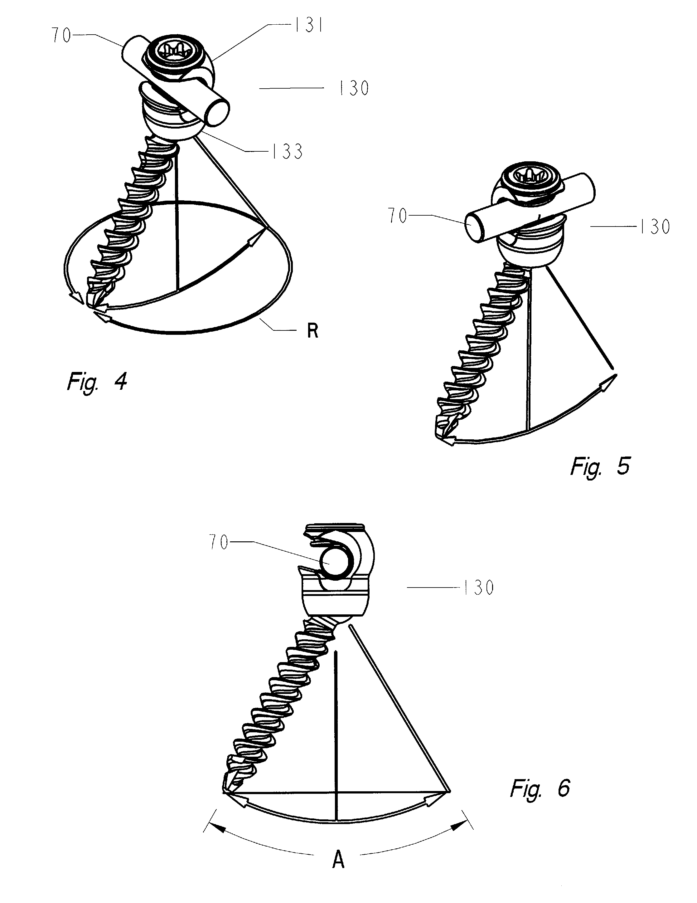 Pedicle screw implant system