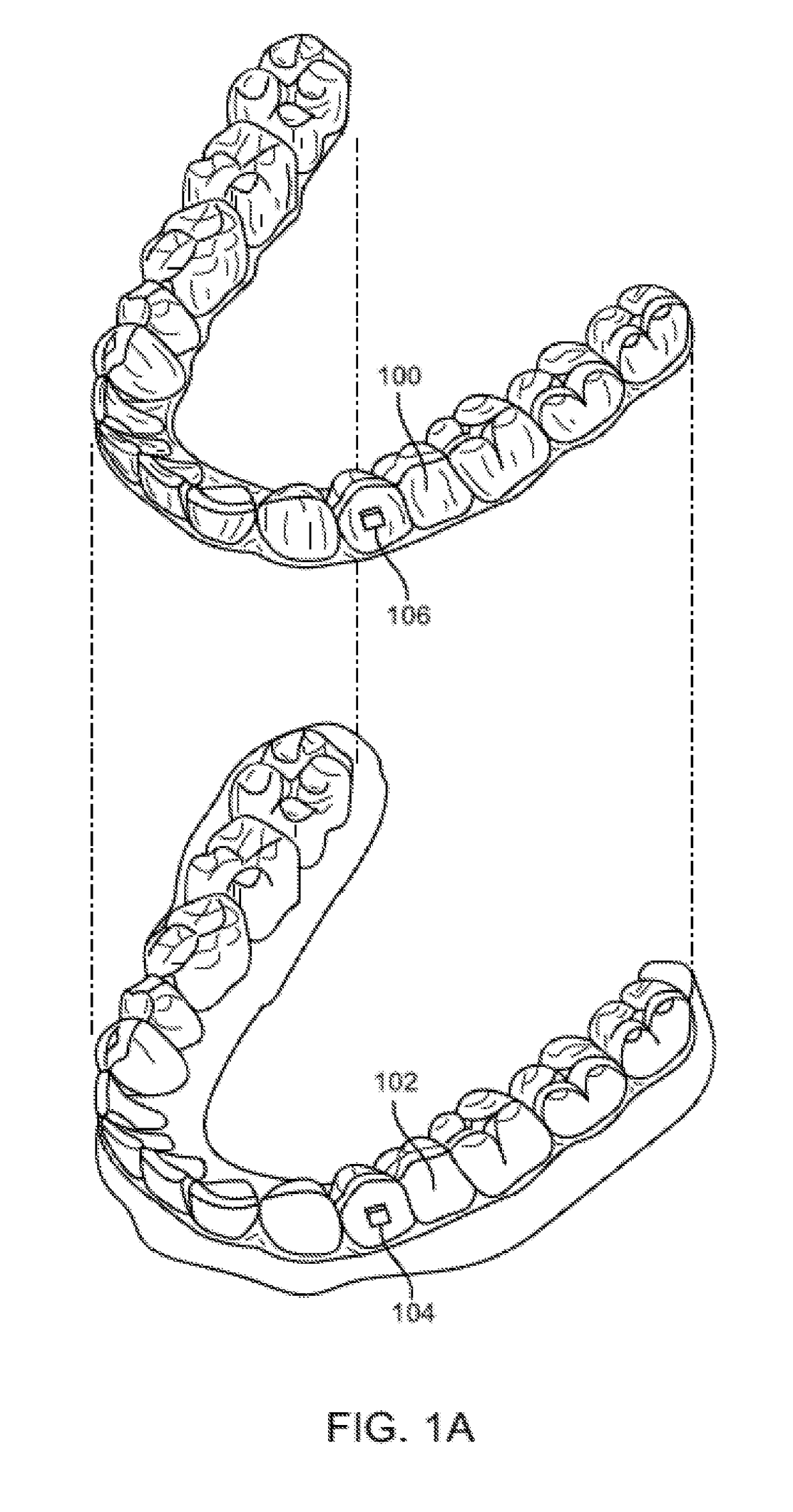 Orthodontic appliance performance monitor