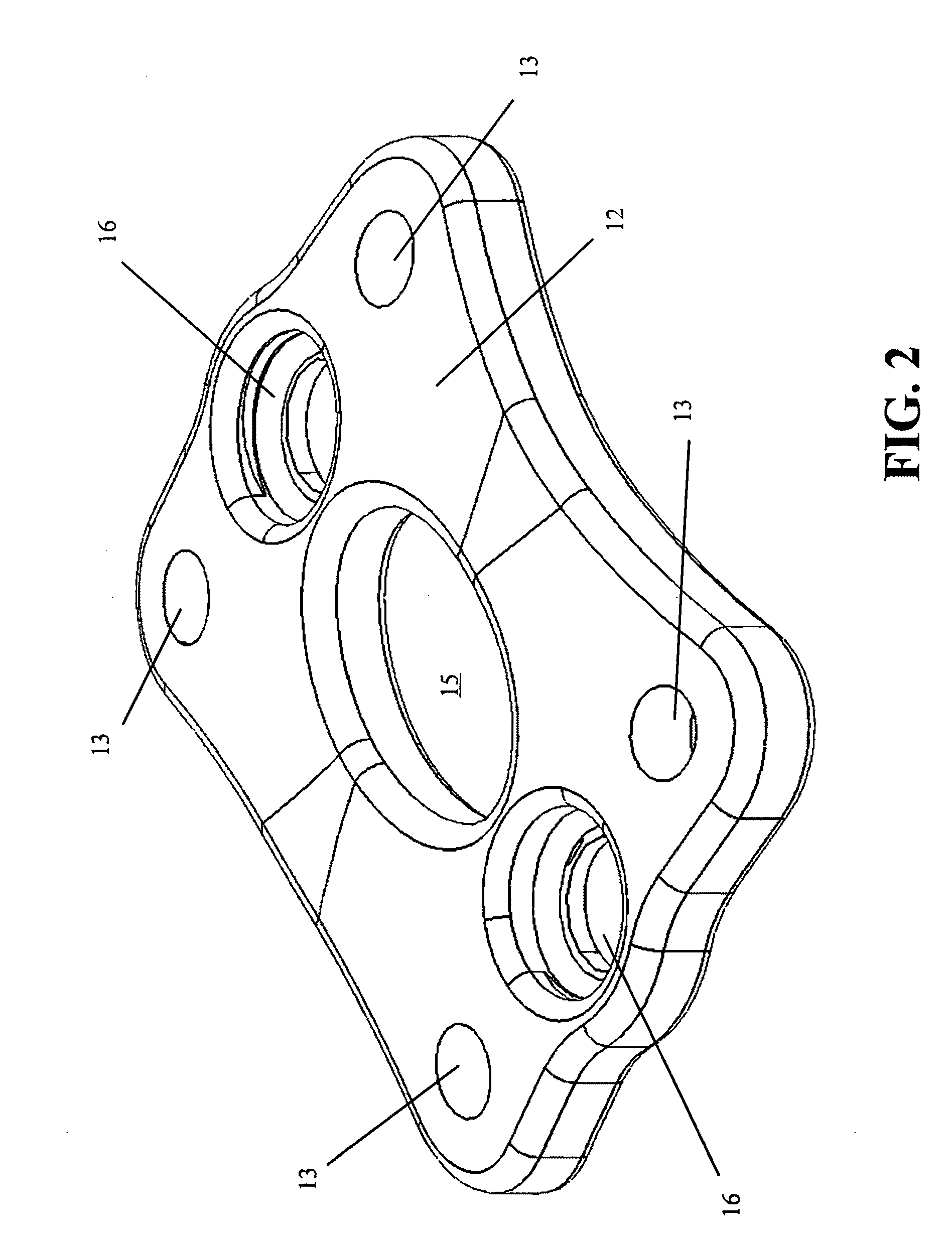 Anterior cervical staple