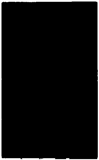 Pharmaceutical composition for preventing or treating onychomycosis and preparation method therefor