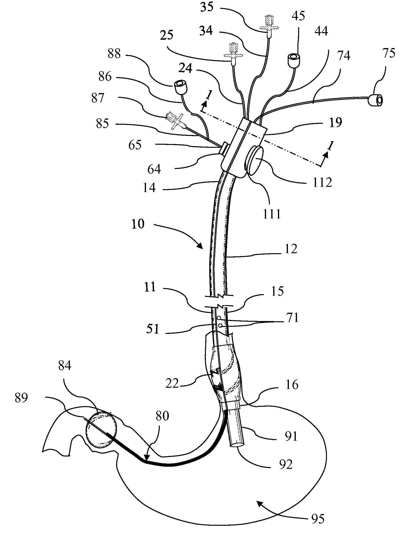 Endoscope Accessory