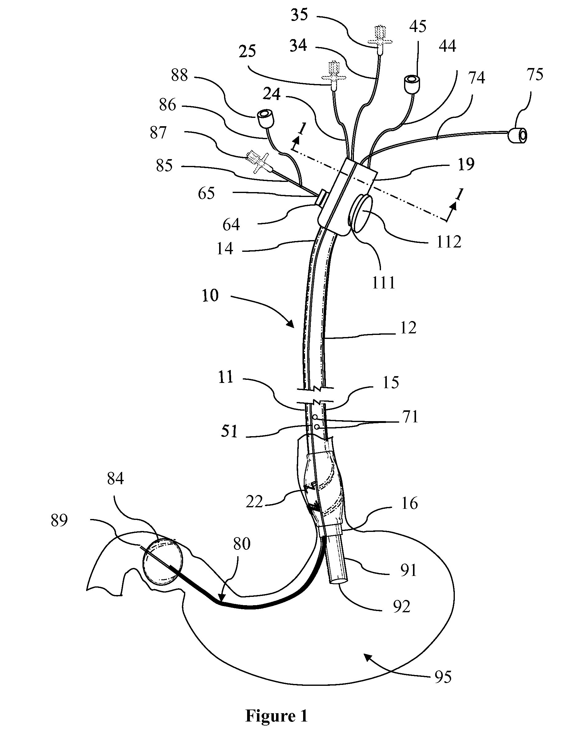 Endoscope Accessory