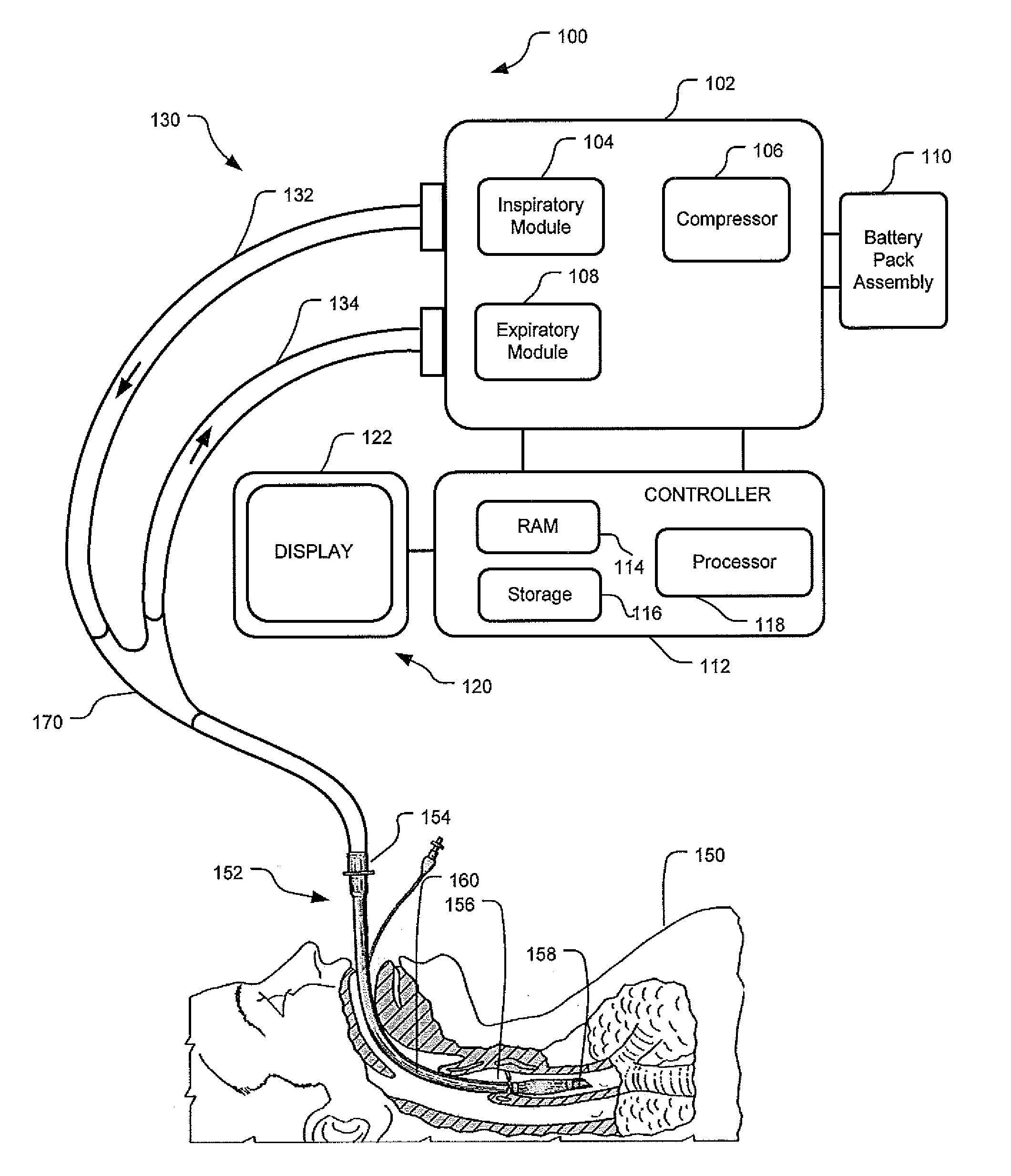 Apparatus And System For A Battery Pack Assembly Used During Mechanical Ventilation