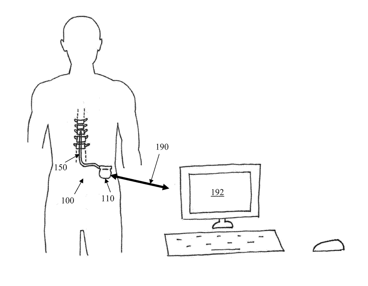 Method and Device for Neural Implant Communication