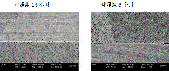 Dentin primary coating-washing primary coating agent and method thereof