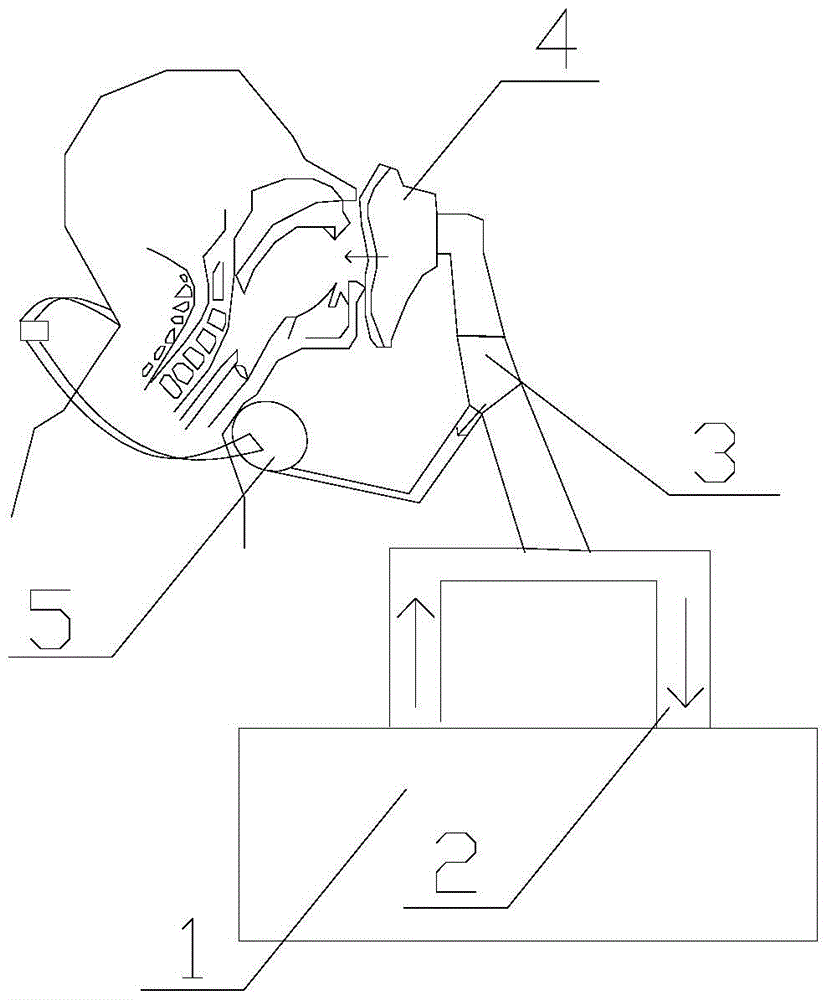 Percutaneous Synchronized Esophageal Compression Ventilation Kit