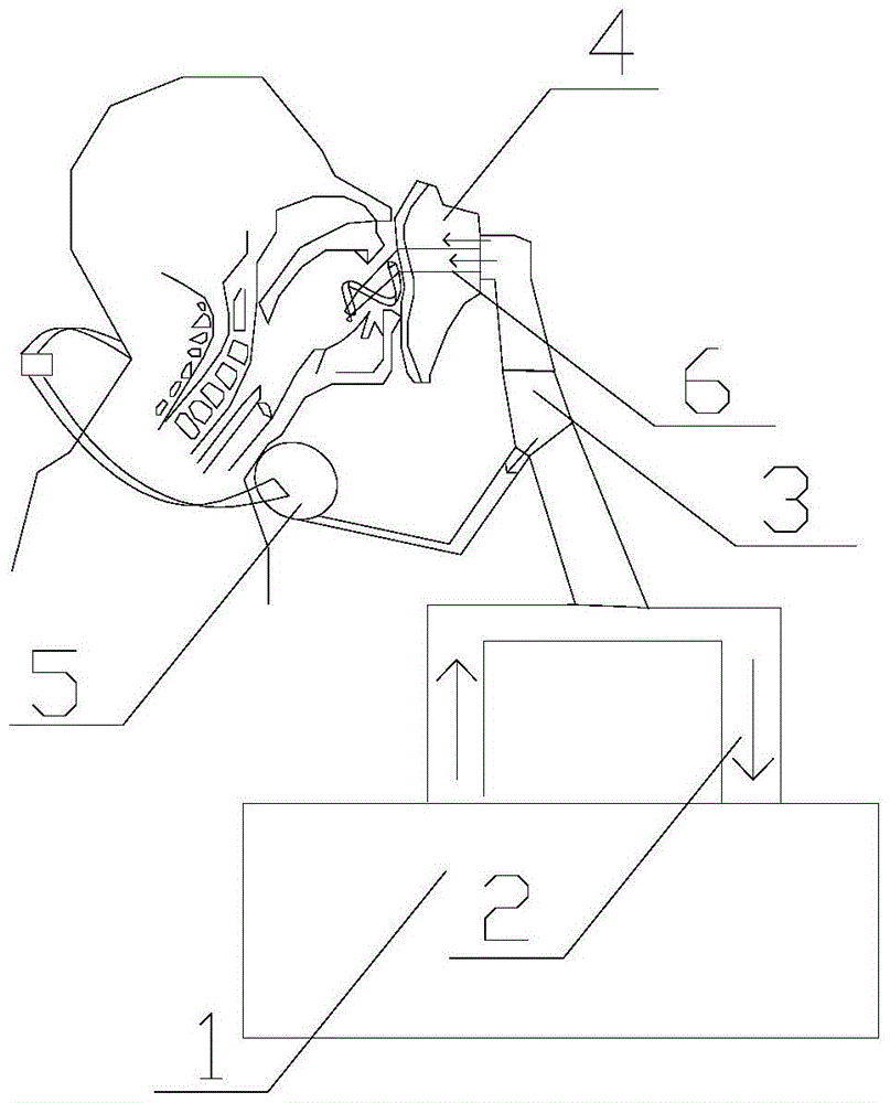 Percutaneous Synchronized Esophageal Compression Ventilation Kit