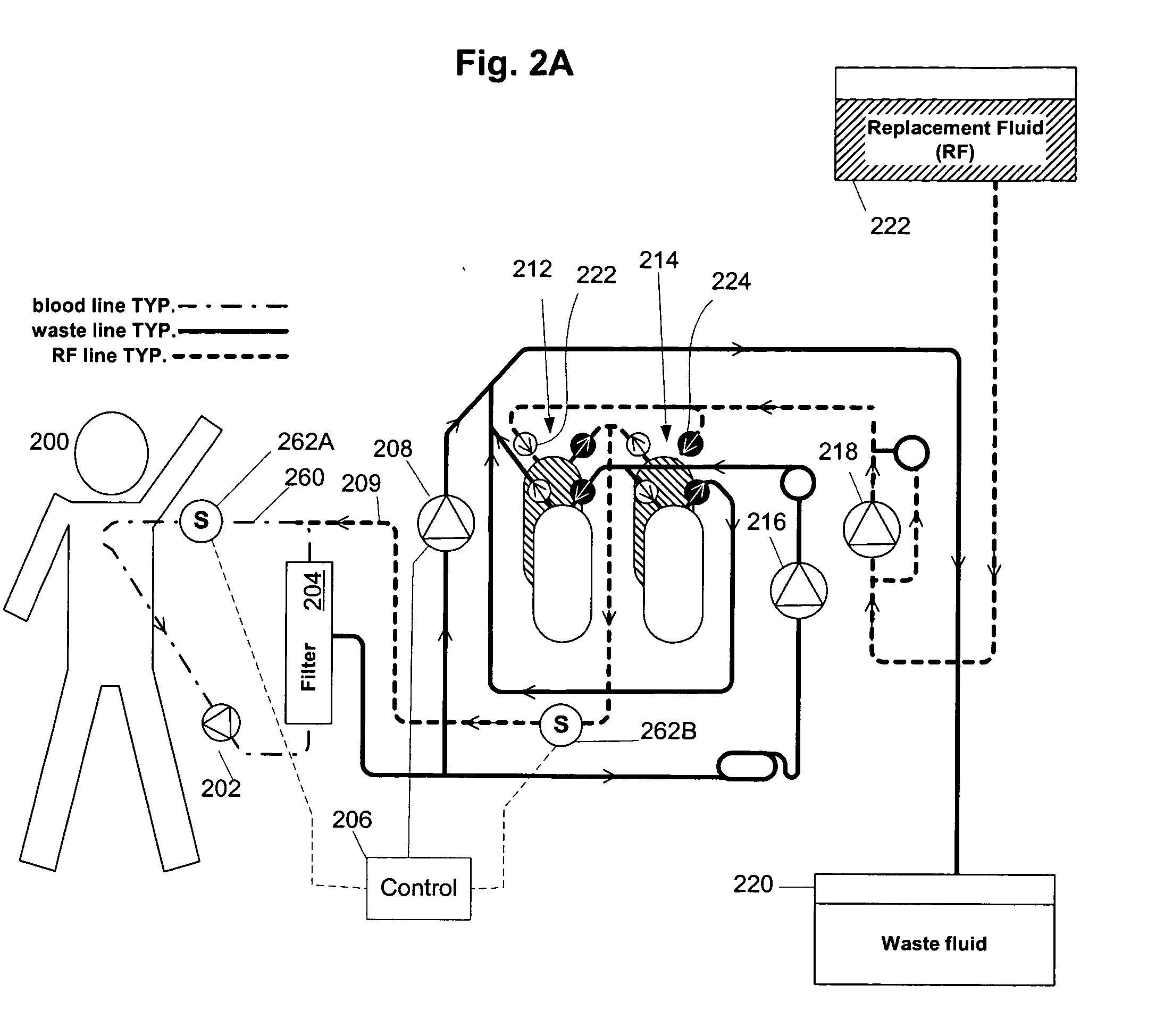 Volumetric fluid balance control for extracorporeal blood treatment