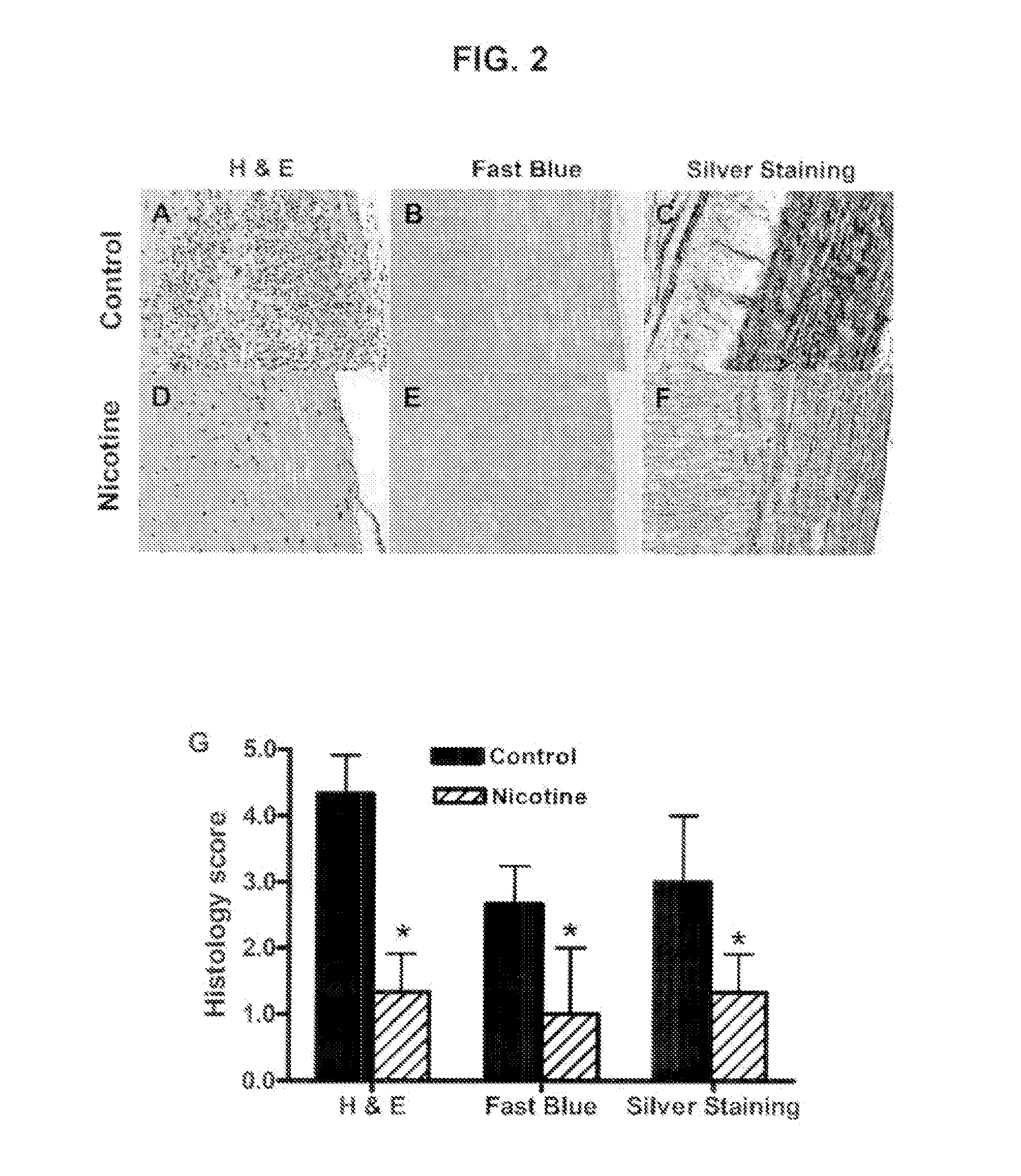 Nicotinic attenuation of CNS inflammation and autoimmunity