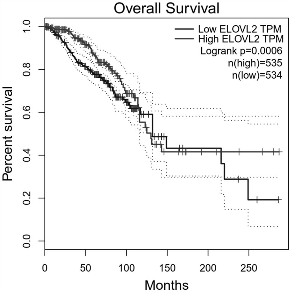 Method for screening immune infiltration related prognostic genes in breast cancer tumor microenvironment