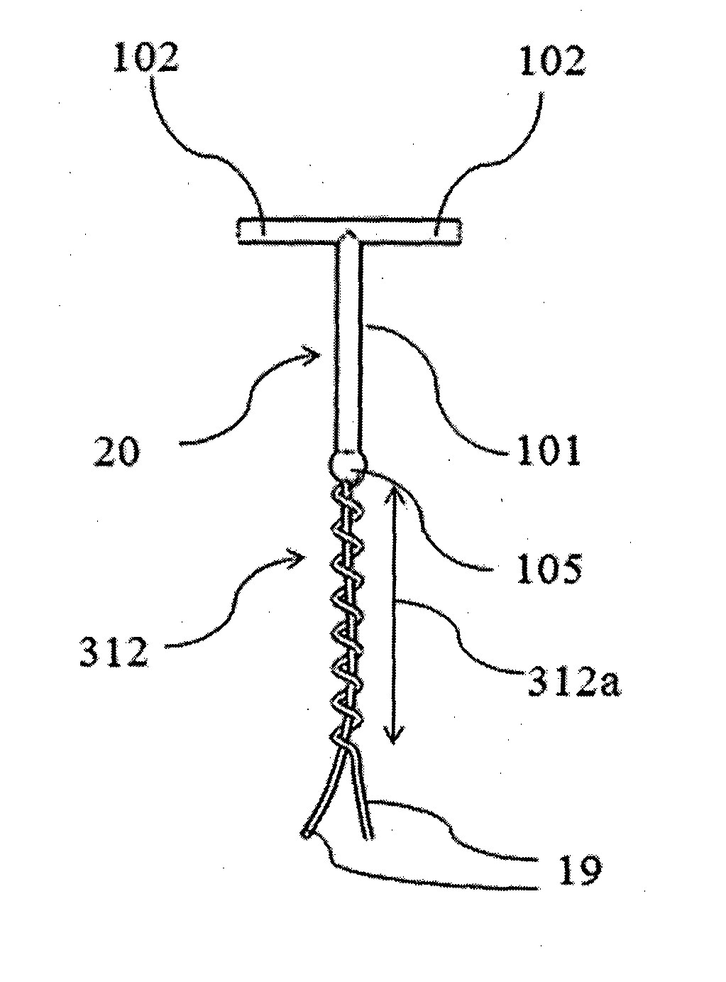 Intrauterine device with a restricted upward movement of a string