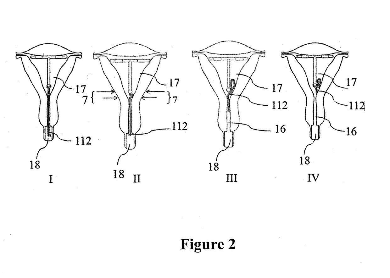 Intrauterine device with a restricted upward movement of a string