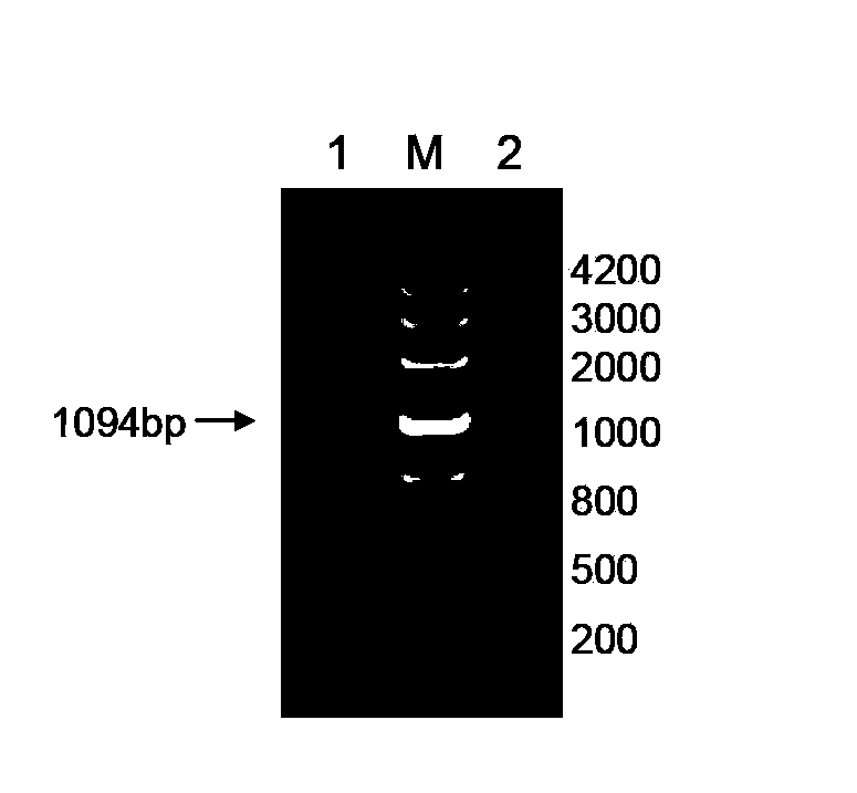 Immunological contraception vaccine and preparation method thereof