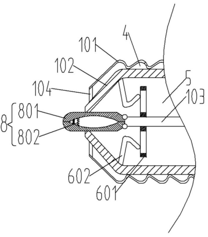 Airway patency device for respiratory support in intensive care department