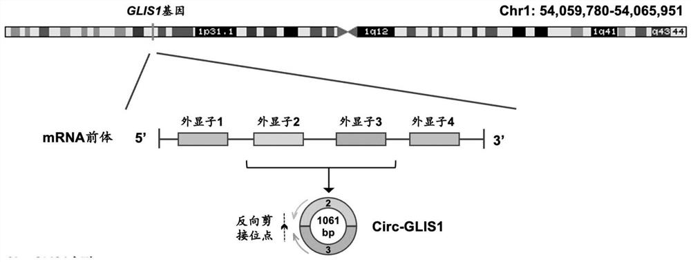 Cyclic RNA (Ribonucleic Acid) biomarker for breast cancer and application of circular RNA biomarker