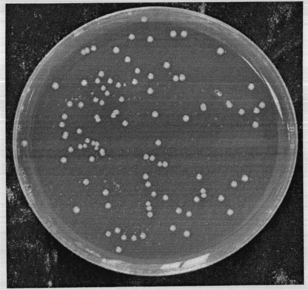 Applications of Bacteroides fragilis in treatment and/or prevention of obesity or diabetes mellitus