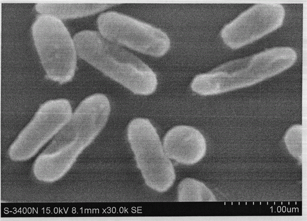 Applications of Bacteroides fragilis in treatment and/or prevention of obesity or diabetes mellitus